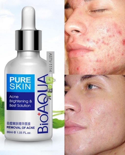 Kit Antiacné 3pz - Pure Skin Bioaqua